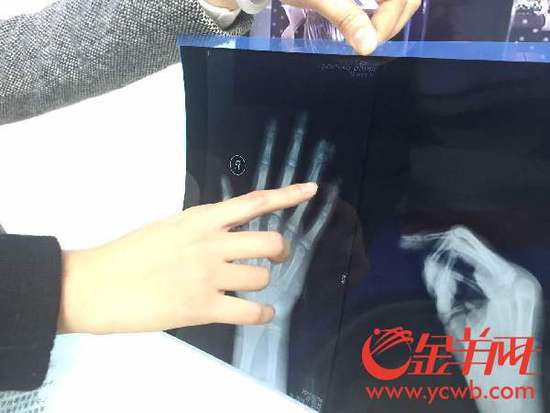 С�^(q��)�������ĊA��ָ����С��ָ�Ǳ��A���� 