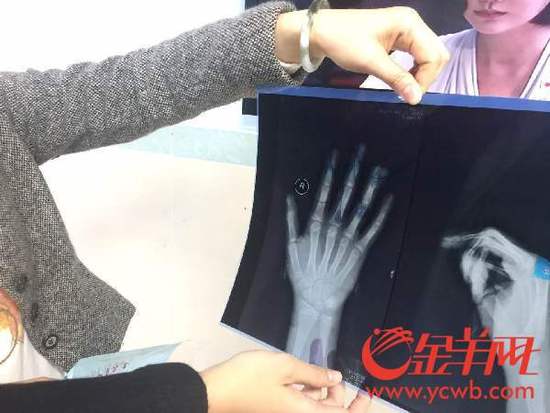 С�^(q��)�������ĊA��ָ����С��ָ�Ǳ��A���� 